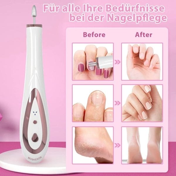 Nagelfrees - nagelvijl - elektrische nagelvijl - automatische nagelvijl - manicure en pedicure - nagelsalon - electric nail file